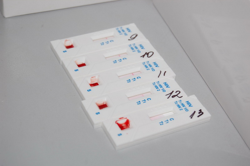 В Симферополе проводится экспресс-тест на ВИЧ