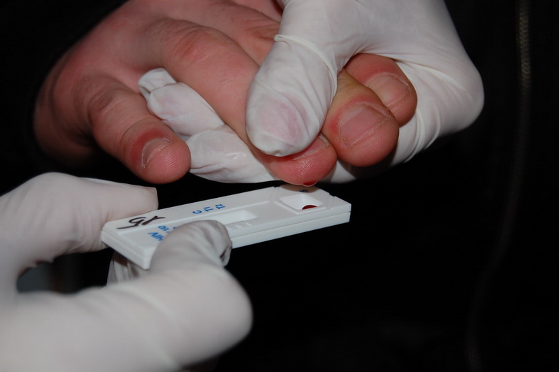 В Симферополе проводится экспресс-тест на ВИЧ