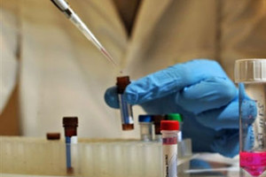 СЭС, В Крыму хотят расширить штат санэпидемслужбы