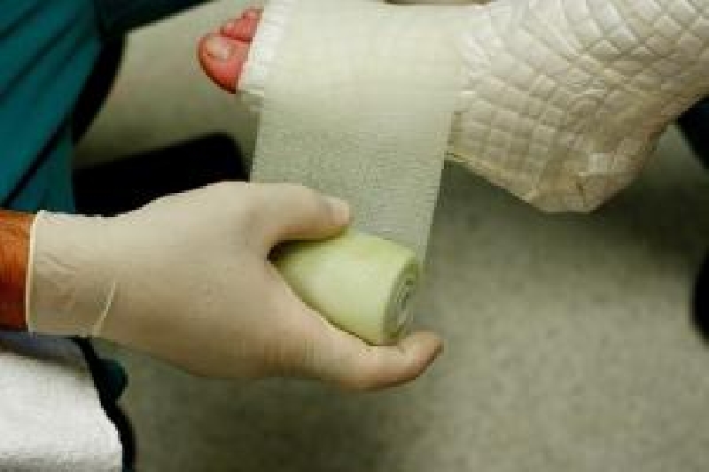 Происшествие, Пенсионерка сломала ногу в горах возле Нового Света