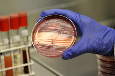 В Севастополе за неделю кишечными инфекциями заболело 60 человек В Севастополе за неделю кишечными инфекциями заболело 60 человек