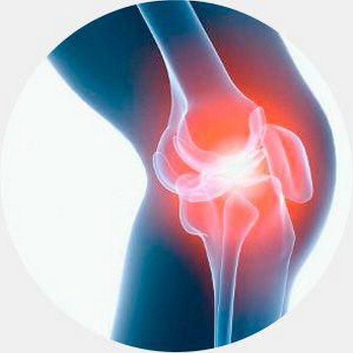 Первая помощь при травме колена