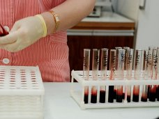 ВИЧ/СПИД, Студенты в Симферополе смогли сделать тест на ВИЧ